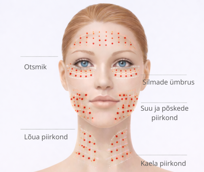 Mikro-tox – pindmine botuliintoksiini protseduur