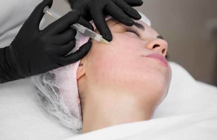 biorevitalisatsioon_dermcorrect_pärnu